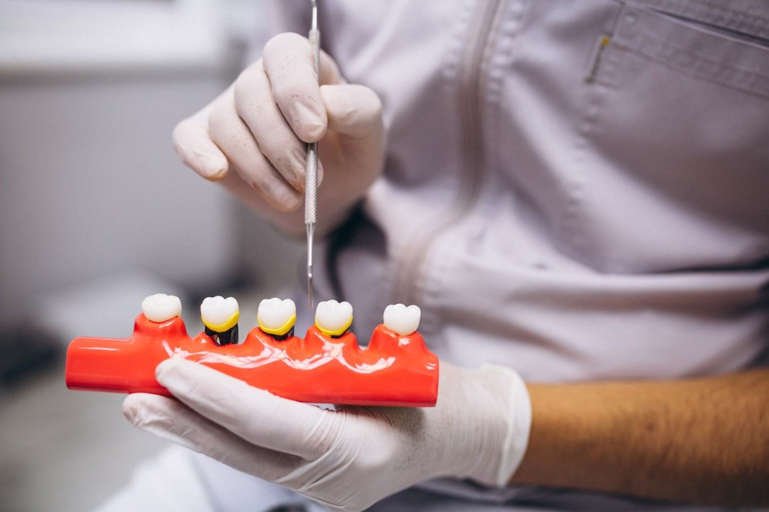 Dental Implants in Huda Colony Panipat
