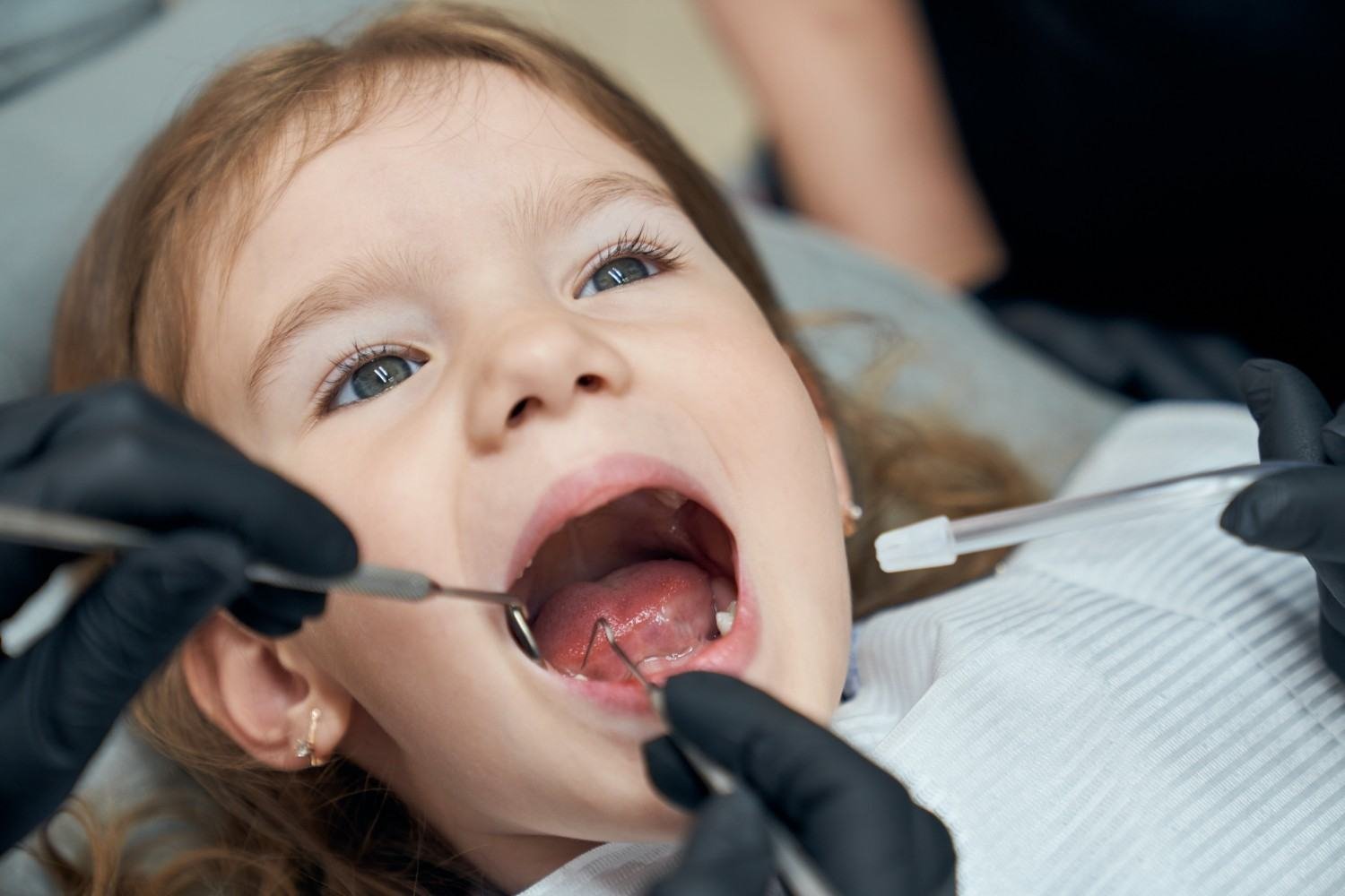 Pediatric Dentist in Panipat
